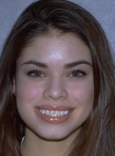 Young brunette woman smiling before dental work