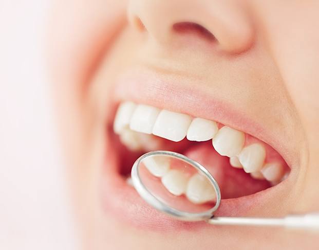Closeup of someone smiling with dental mirror at their teeth