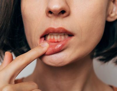 Lady shows inflamed gums