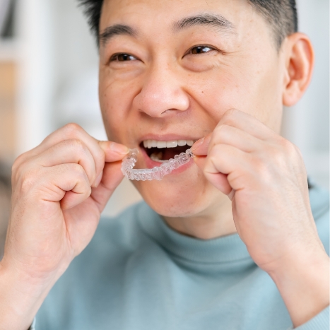 Man putting clear aligner into his mouth