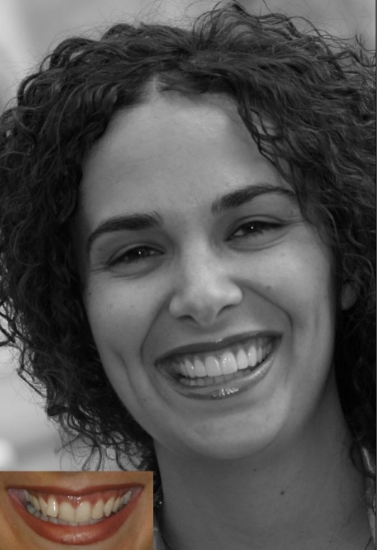 Woman with curly dark hair smiling next to before photo of her smile