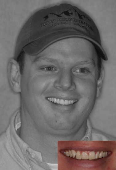 Man smiling with close up of his smile before dental work in corner