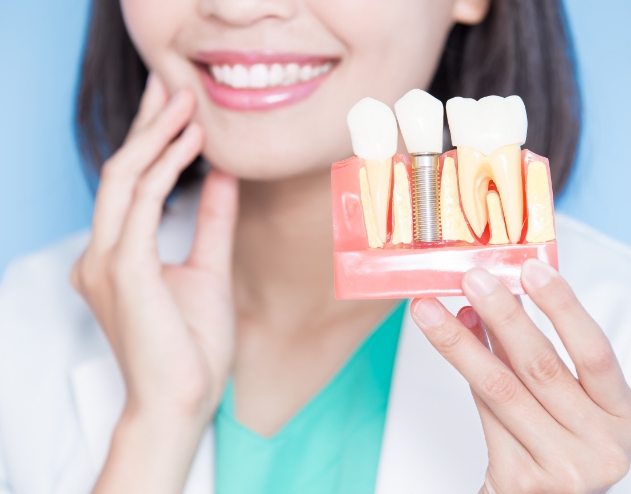 Dentist holding a model of a dental implant