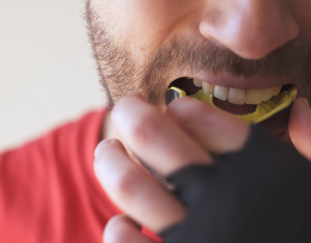 Man placing a yellow mouthguard over his teeth