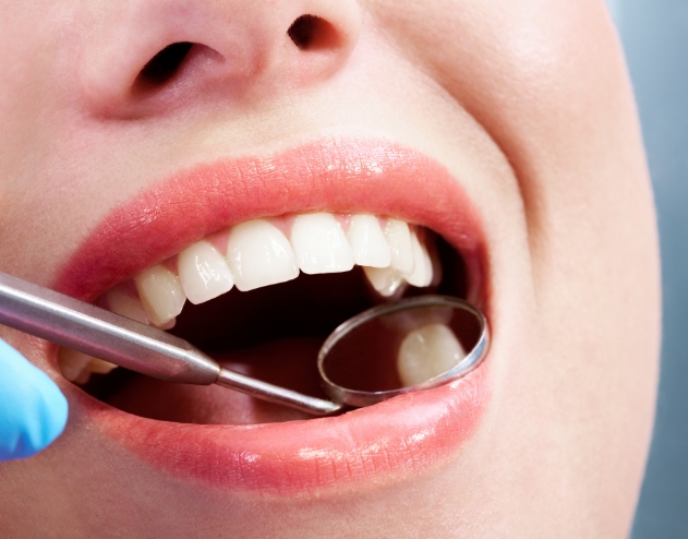 Close up of person with dental mirror in their mouth